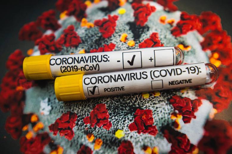 covid-19 koronawirus wynik testu