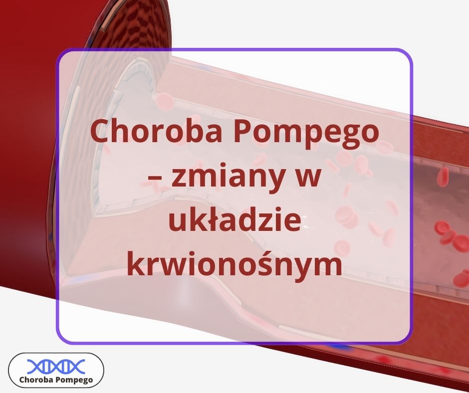 Choroba Pompego - zmiany w układzie krwionośnym