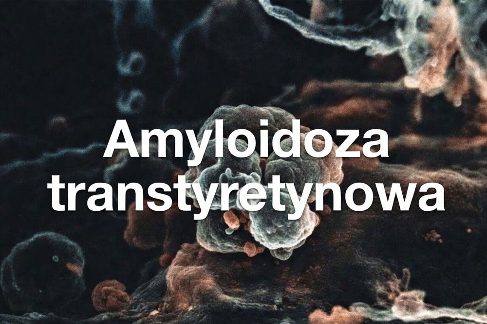amyloidoza